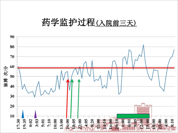 医院药学分会场-毛敏课件：2例缓慢性心律失常：源于甲亢？还是甲减？抑或是其他？-13.gif