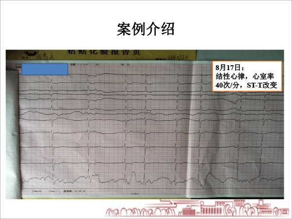 医院药学分会场-毛敏课件：2例缓慢性心律失常：源于甲亢？还是甲减？抑或是其他？-4.gif