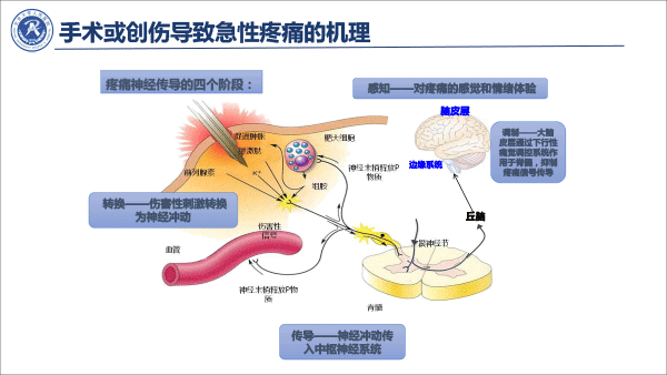疼痛治疗的合理用药——冯艺1213-12.gif